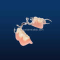 Plain pink buong pustiso